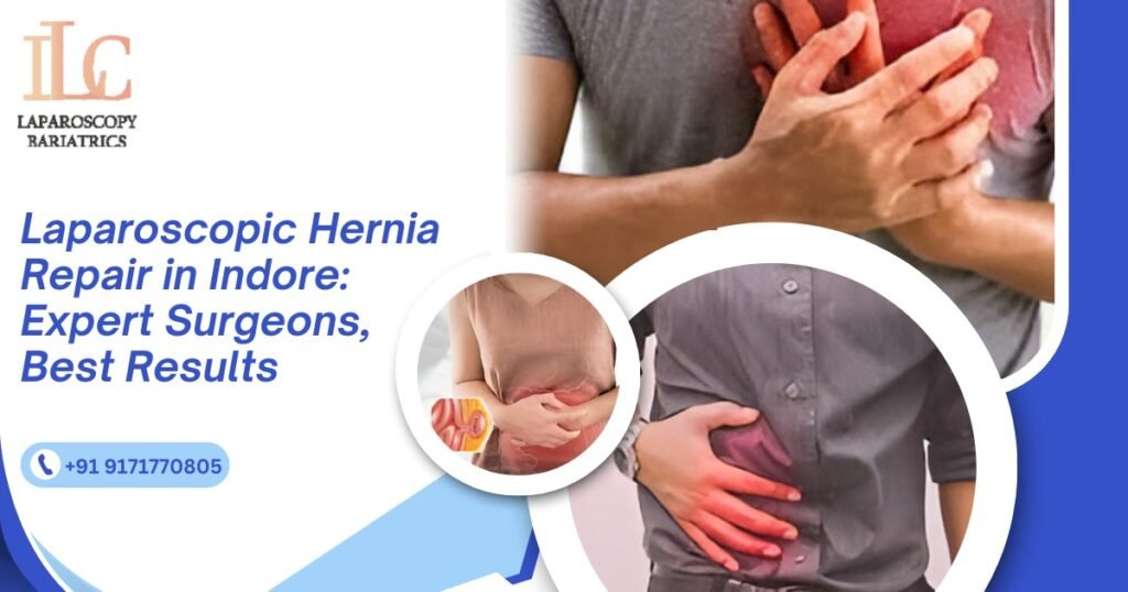 Laparoscopic Hernia Repair in Indore