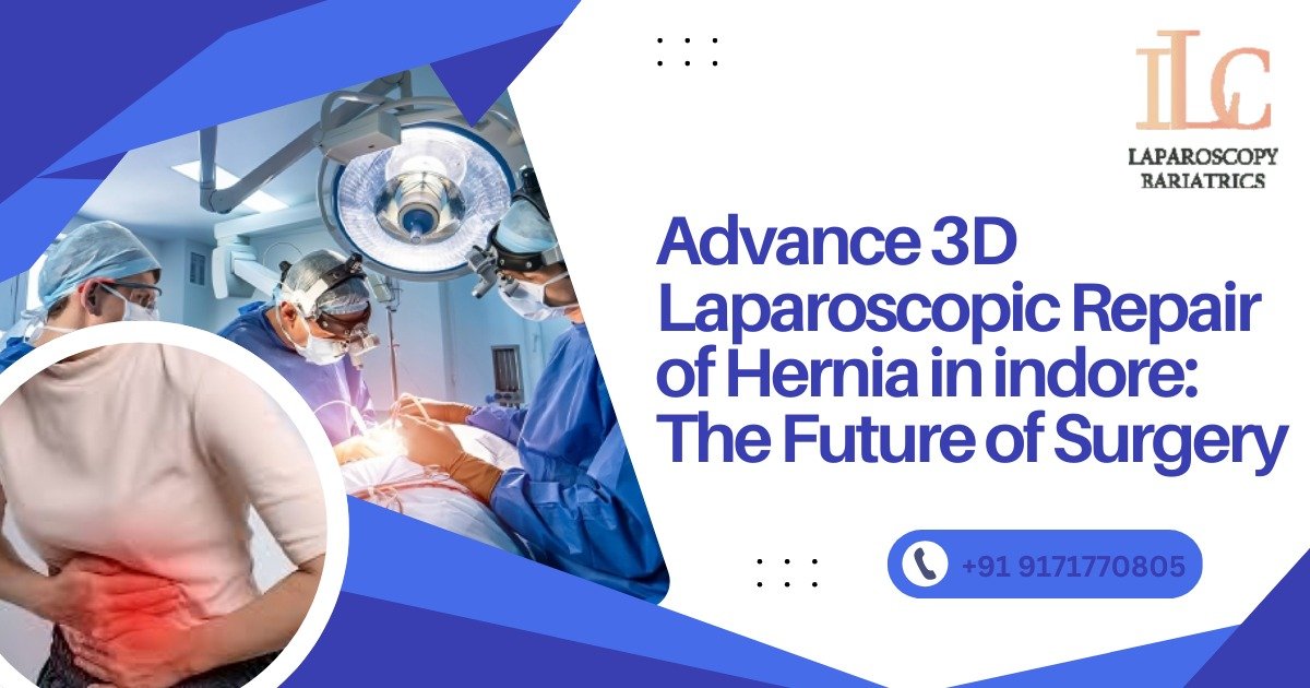 Advanced 3D Laparoscopic Repair of Hernia in Indore