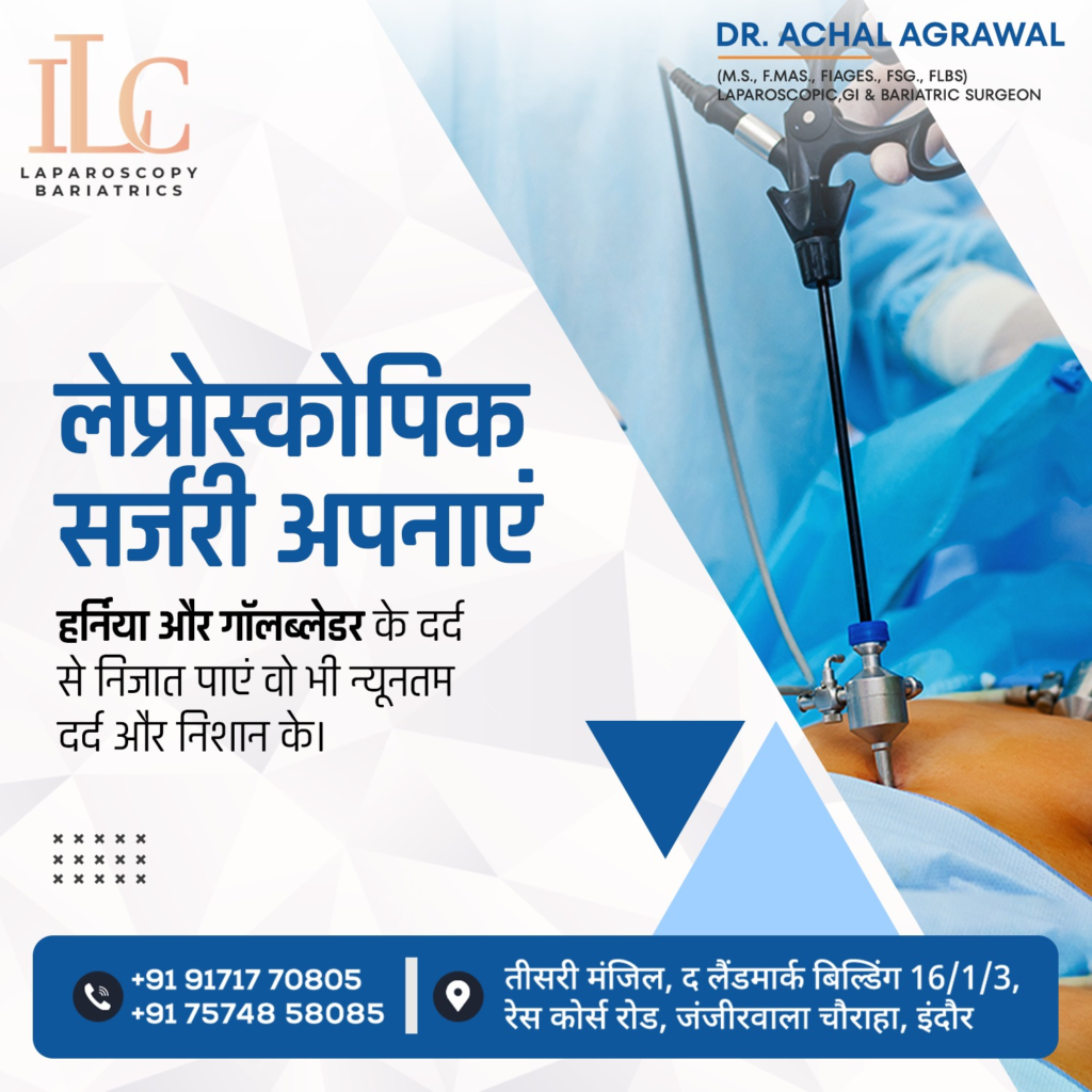 Laparoscopic Hernia Surgery Cost in Indore