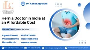 Hernia Doctor in India at an Affordable Cost