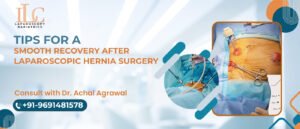 Tips for a Smooth Recovery After Laparoscopic Hernia Surgery
