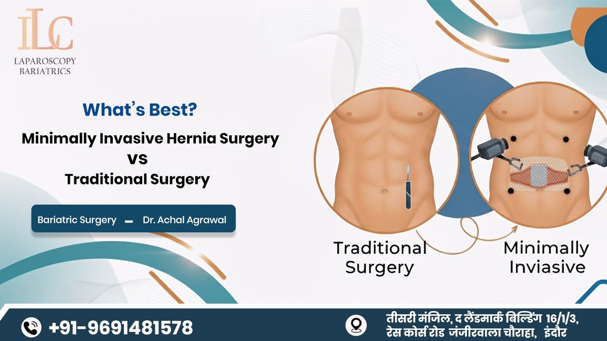 Minimally Invasive Hernia Surgery vs Traditional Surgery: What’s Best?
