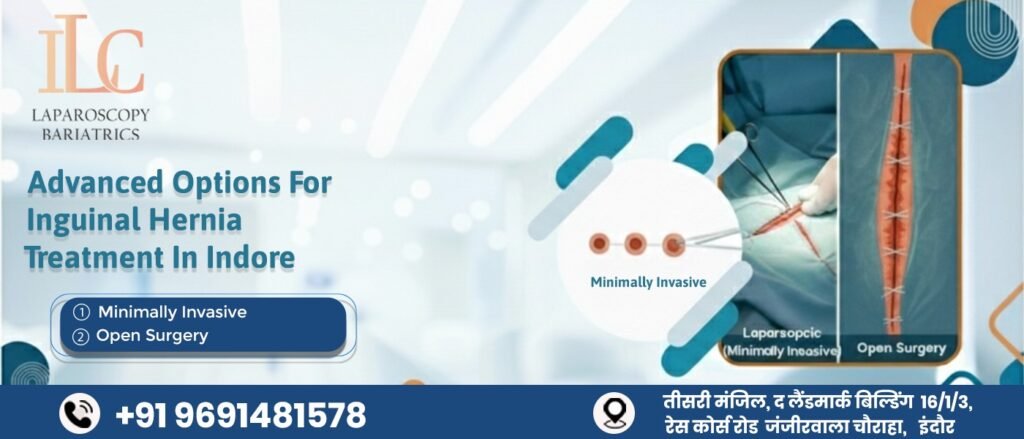 Inguinal Hernia Treatment in Indore