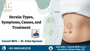 Types, Symptoms, Causes, and Treatment