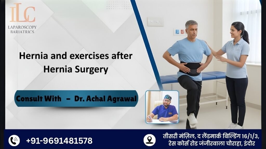 Hernia and exercises after hernia surgery