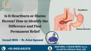 Is It Heartburn or Hiatus Hernia