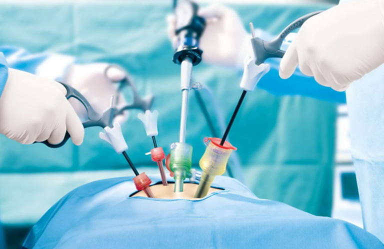 High-tech Laparoscopic & Minimally Invasive Surgery