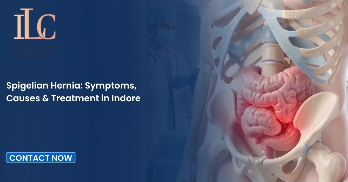 Spigelian Hernia: Symptoms, Causes & Treatment in Indore