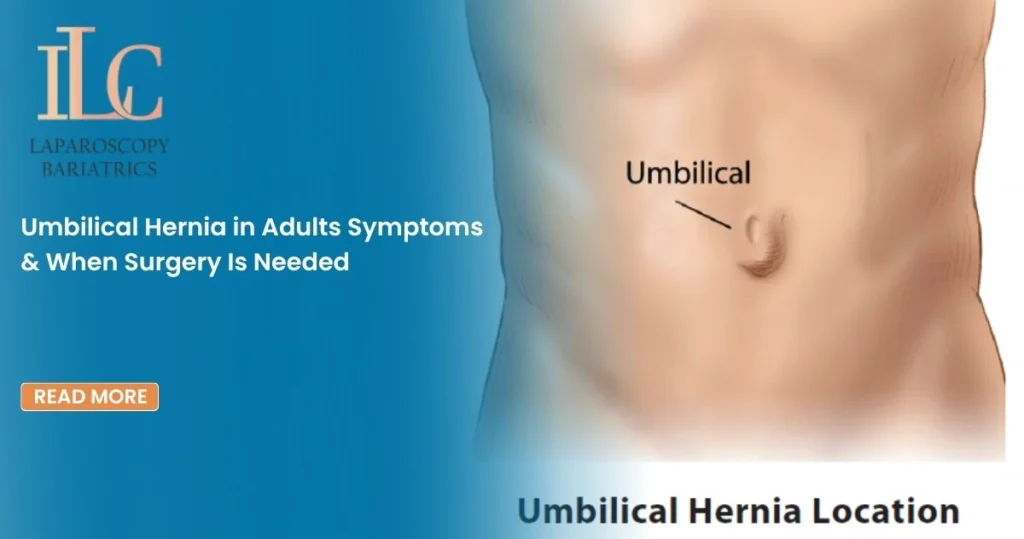 Umbilical Hernia in Adults Symptoms & When Surgery Is Needed