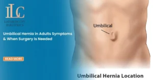 Umbilical Hernia in Adults Symptoms & When Surgery Is Needed