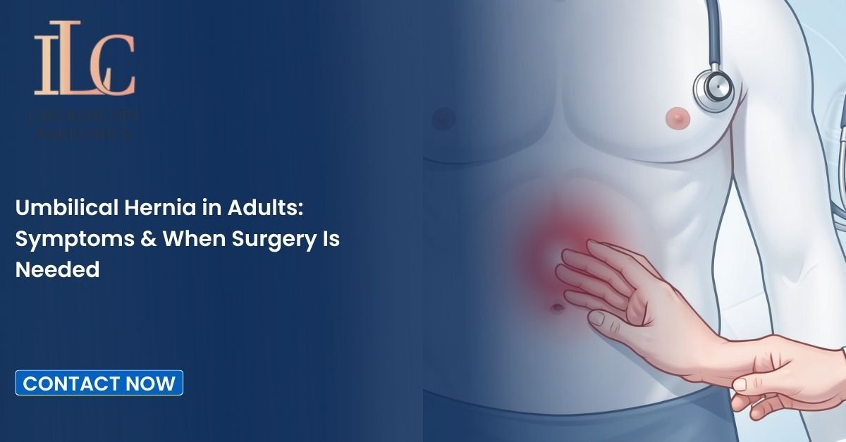 Umbilical Hernia in Adults Symptoms & When Surgery Is Needed