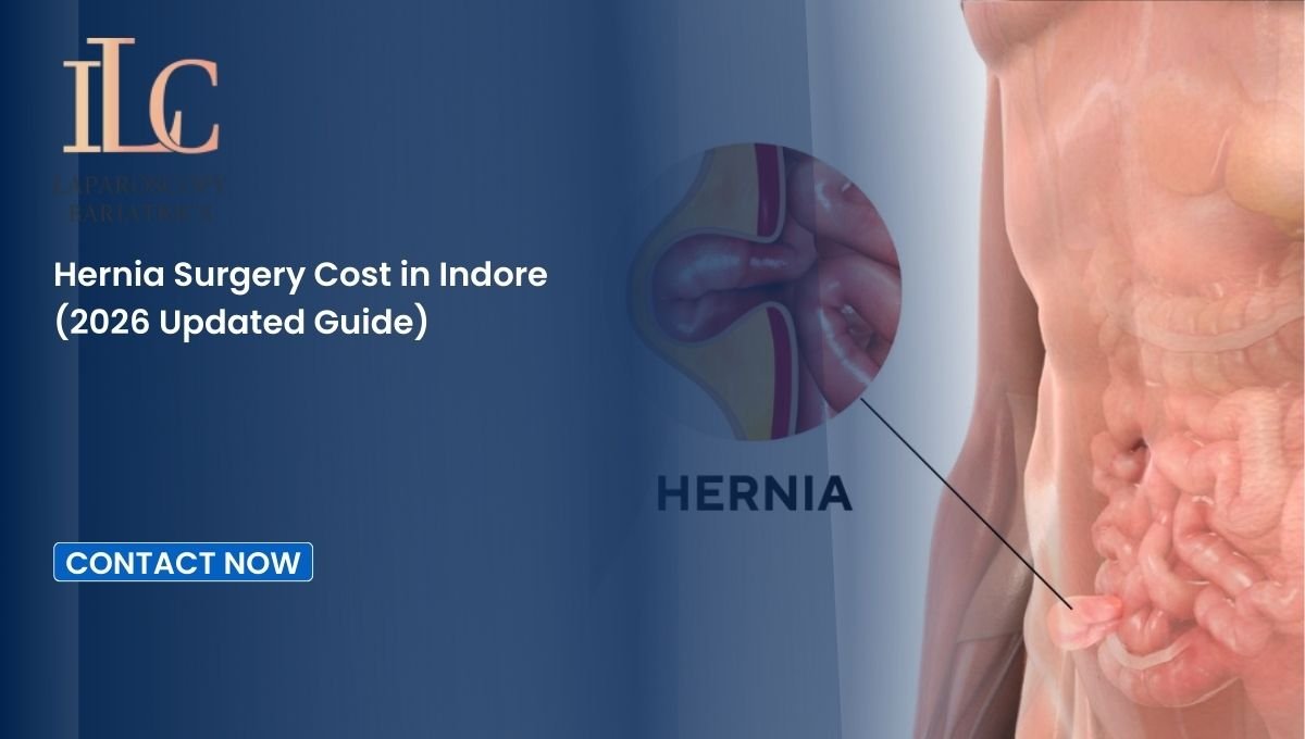 Hernia Surgery Cost in Indore (2026 Updated Guide)