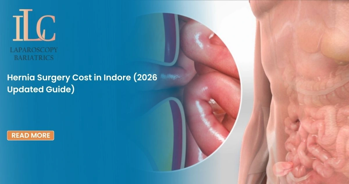 Hernia Surgery Cost in Indore (2026 Updated Guide)