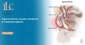 Inguinal Hernia Causes, Symptoms & Treatment Options