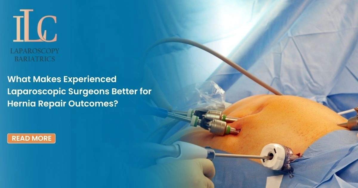 What Makes Experienced Laparoscopic Surgeons Better for Hernia Repair Outcomes (2)