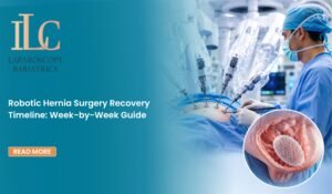 Robotic Hernia Surgery Recovery Timeline: Week-by-Week Guide