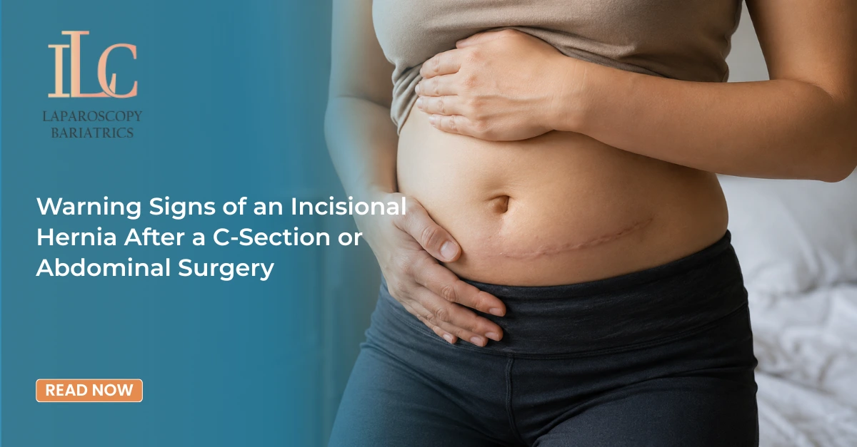 Warning Signs of an Incisional Hernia After a C-Section or Abdominal Surgery